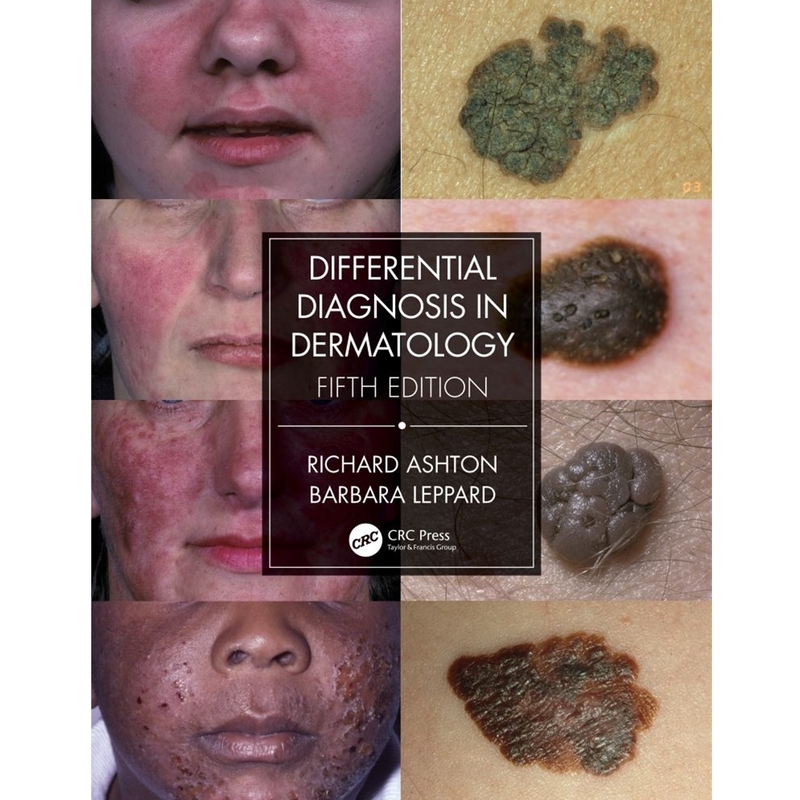 9780367085971 Differential Diagnosis In Dermatology 5/E