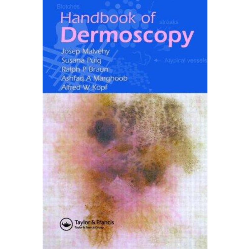 9780415384902 Handbook Of Dermoscopy (1/E)