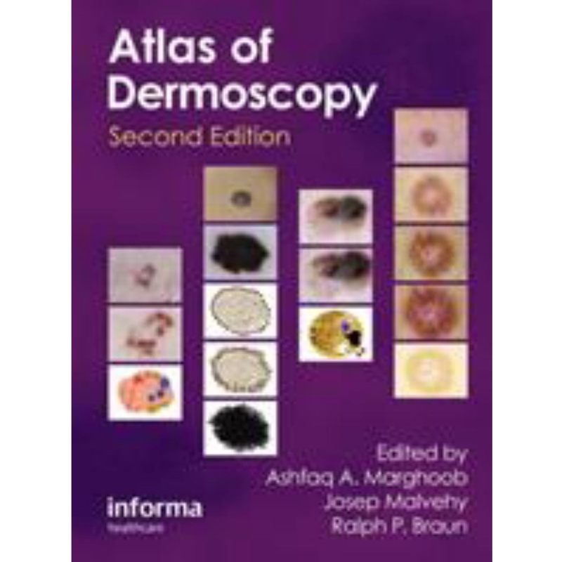 9780415458955 An Atlas Of Dermoscopy 2/E