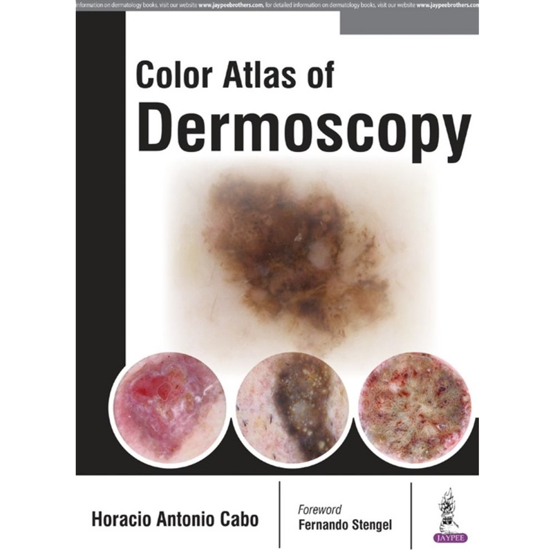 9789386056306 Color Atlas Of Dermoscopy